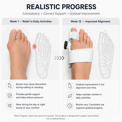 Bunion Corrector