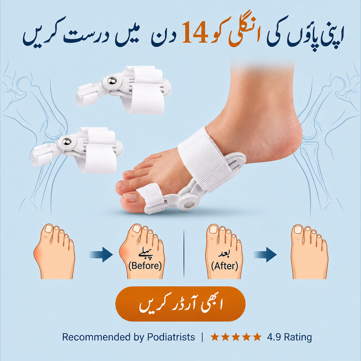 Bunion Corrector
